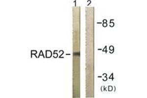 Western blot analysis of extracts from 293 cells, using RAD52 (Ab-104) Antibody. (RAD52 抗体  (AA 70-119))