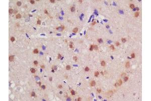 Formalin-fixed and paraffin embedded rat brain labeled with Rabbit Anti-Guanylyl Cyclase alpha 1 Polyclonal Antibody, Unconjugated  at 1:200 followed by conjugation to the secondary antibody and DAB staining (GUCY1A1 抗体  (AA 301-400))