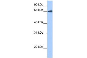 WB Suggested Anti-ZNF417 Antibody Titration:  0. (ZNF417 抗体  (N-Term))