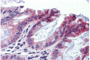 Human Colon (formalin-fixed, paraffin-embedded) stained with TULP2 antibody ABIN462210 followed by biotinylated goat anti-rabbit IgG secondary antibody ABIN481713, alkaline phosphatase-streptavidin and chromogen. (TULP2 抗体  (N-Term))