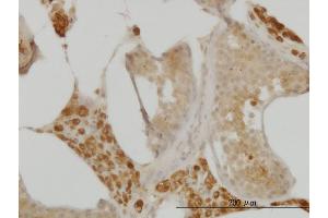 Immunoperoxidase of monoclonal antibody to C10orf7 on formalin-fixed paraffin-embedded human testis. (CDC123 抗体  (AA 1-336))