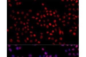 Immunofluorescence analysis of 293T cells using XRCC4 Polyclonal Antibody at dilution of 1:100. (XRCC4 抗体)