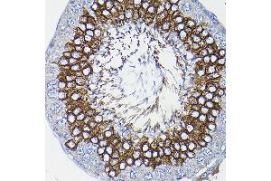 Immunohistochemistry of paraffin-embedded rat testis using ICMT Rabbit pAb (ABIN6128077, ABIN6142129, ABIN6142130 and ABIN6214491) at dilution of 1:200 (40x lens). (ICMT 抗体  (AA 175-284))