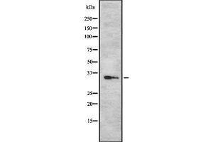 Western blot analysis Sarcoglycan-β using Jurkat whole cell lysates (SGCB 抗体  (N-Term))