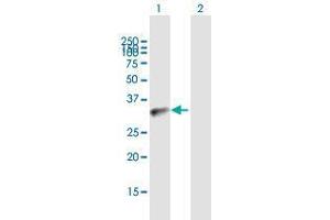 Western Blot analysis of BCL11A expression in transfected 293T cell line by BCL11A MaxPab polyclonal antibody. (BCL11A 抗体  (AA 1-243))