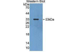 Western blot analysis of the recombinant protein. (CA13 抗体  (AA 1-262))