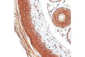Immunohistochemistry of paraffin-embedded rat skin using PERP Rabbit mAb (ABIN7270861) at dilution of 1:100 (40x lens). (PERP 抗体)