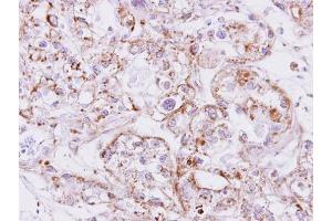 IHC-P Image Immunohistochemical analysis of paraffin-embedded CLEAR CELL OVCA xenograft, using Inhibin beta A, antibody at 1:500 dilution. (INHBA 抗体  (C-Term))