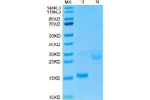 SDS-PAGE (SDS) image for Growth Differentiation Factor 15 (GDF15) (AA 193-308) protein (His tag) (ABIN7274718)