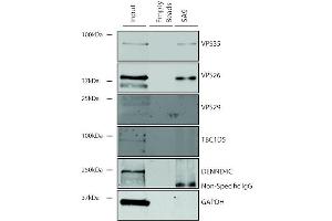 Immunoprecipitation analysis using Mouse Anti-VPS35 Monoclonal Antibody, Clone 5A9 (ABIN6932951). (VPS35 抗体  (HRP))