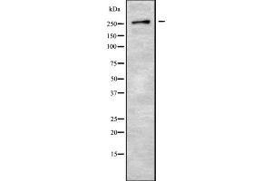 Western blot analysis GPR179 using 293 whole cell lysates (GPR179 抗体  (C-Term))