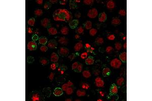 Immunofluorescence (IF) image for anti-Solute Carrier Family 2 (Facilitated Glucose Transporter), Member 1 (SLC2A1) (AA 203-305) antibody (ABIN6940594)