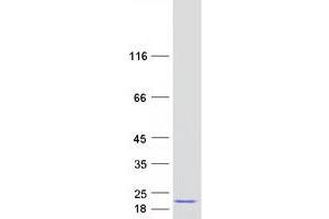 Western Blotting (WB) image for Peptidylprolyl Isomerase H (Cyclophilin H) (PPIH) protein (Myc-DYKDDDDK Tag) (ABIN2712742)