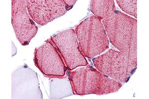 Immunohistochemistry (IHC) image for anti-Wingless-Type MMTV Integration Site Family, Member 5B (WNT5B) (Middle Region) antibody (ABIN2776725) (WNT5B 抗体  (Middle Region))