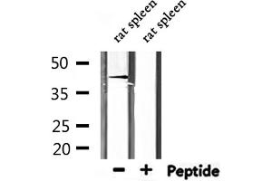 Western Blotting (WB) image for anti-Retinoic Acid Receptor, alpha (RARA) (N-Term) antibody (ABIN6264642)