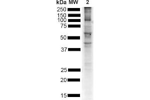Western Blot analysis of Mouse Brain showing detection of Alpha Synuclein pSer129 protein using Rabbit Anti-Alpha Synuclein pSer129 Monoclonal Antibody, Clone J18 (ABIN6932878). (SNCA 抗体  (pSer129) (FITC))