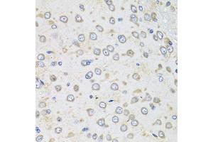 Immunohistochemistry of paraffin-embedded rat brain using Albumin antibody (ABIN3020953, ABIN3020954, ABIN3020955 and ABIN6213817) at dilution of 1:100 (40x lens). (Albumin 抗体  (AA 20-255))