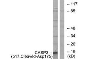 Western blot analysis of extracts from COLO cells, using Caspase 3 (p17,Cleaved-Asp175) Antibody.