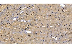 Detection of RIPK1 in Mouse Cerebrum Tissue using Polyclonal Antibody to Receptor Interacting Serine Threonine Kinase 1 (RIPK1)