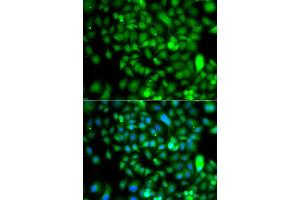 Immunofluorescence analysis of A549 cell using CSRP2BP antibody. (CSRP2BP 抗体)