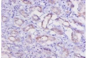 Immunohistochemistry of paraffin-embedded human kidney tissue using ABIN7178829 at dilution of 1:20 (Cathepsin K 抗体  (AA 115-329))