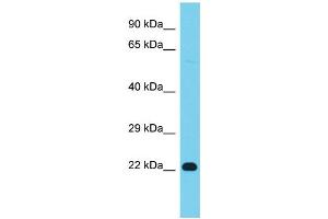 Western Blotting (WB) image for anti-V-Ral Simian Leukemia Viral Oncogene Homolog B (Ras Related, GTP Binding Protein) (Ralb) (Middle Region) antibody (ABIN2786741)