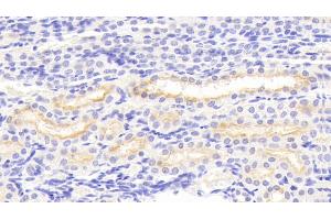 Detection of MMP3 in Porcine Kidney Tissue using Polyclonal Antibody to Matrix Metalloproteinase 3 (MMP3) (MMP3 抗体  (AA 18-477))