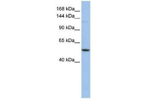 WB Suggested Anti-UBE4A Antibody Titration:  0. (UBE4A 抗体  (Middle Region))