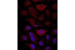 Immunofluorescence (IF) image for anti-Ribosomal Protein L21 (RPL21) (AA 1-160) antibody (ABIN7269996)