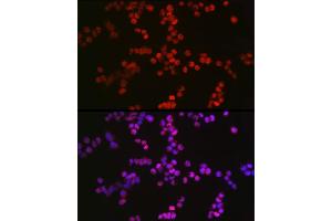 Immunofluorescence analysis of F9 cells using TET2 Rabbit pAb (ABIN7270780) at dilution of 1:100 (40x lens). (TET2 抗体)