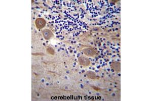 Immunohistochemistry (IHC) image for anti-Signal Sequence Receptor, beta (Translocon-Associated Protein Beta) (SSR2) antibody (ABIN2997190) (SSR2 抗体)