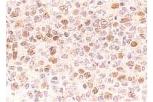 Immunohistochemistry (IHC) image for anti-Cell Division Cycle 7 (CDC7) antibody (ABIN487481) (CDC7 抗体)