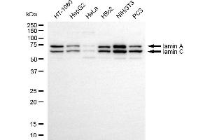Western blotting analysis using Iamin A/C antibody (ABIN7799229).