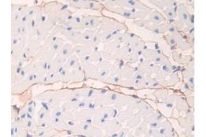 Detection of FBN1 in Mouse Heart Tissue using Polyclonal Antibody to Fibrillin 1 (FBN1) (Fibrillin 1 抗体  (AA 1703-1889))