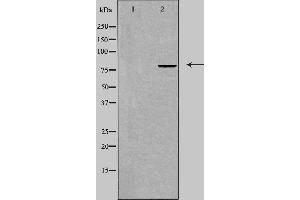 Western blot analysis of extracts from COLO cells, using TRIM3 antibody. (TRIM3 抗体  (Internal Region))