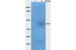 Lane 1: mouse brain lysates Lane 2: mouse kidney lysates probed with Anti AVPR2 Polyclonal Antibody, Unconjugated (ABIN1385866) at 1:200 in 4 °C. (AVPR2 抗体  (AA 65-170))