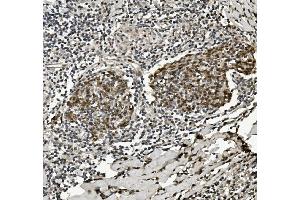 IHC analysis of HP1 alpha/CBX5 using anti-HP1 alpha/CBX5 antibody (ABIN7599058).