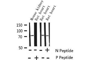 Western blot analysis of Phospho-Tau (Thr231) expression in various lysates (MAPT 抗体  (pThr231))