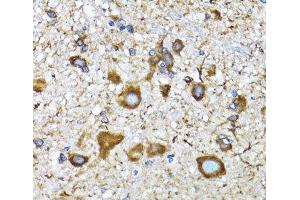 Immunohistochemistry of paraffin-embedded Mouse spinal cord using MAP1LC3A Polyclonal Antibody at dilution of 1:100 (40x lens). (MAP1LC3A 抗体)