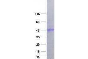 Western Blotting (WB) image for Hemochromatosis (HFE) (Transcript Variant 9) protein (Myc-DYKDDDDK Tag) (ABIN2722686)