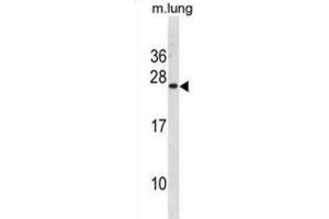 Western Blotting (WB) image for anti-Iron-sulfur cluster assembly enzyme ISCU, mitochondrial (ISCU) antibody (ABIN3001333) (ISCU 抗体)