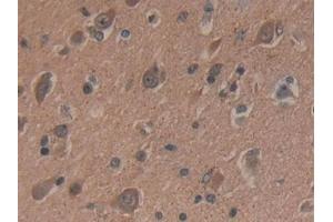 Detection of dSIP in Human Brain Tissue using Polyclonal Antibody to Delta-Sleep Inducing Peptide (dSIP) (dSIP (AA 1-134) 抗体)