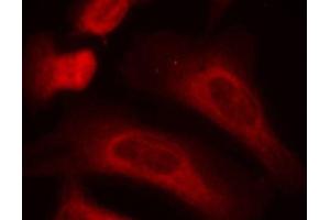 Immunofluorescence staining of methanol-fixed HeLa cells using Phospho-STAT1-S727 antibody (ABIN2988310). (STAT1 抗体  (pSer727))