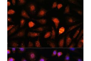 Immunofluorescence analysis of L-929 cells using CDK5RAP1 Polyclonal Antibody at dilution of 1:100. (CDK5RAP1 抗体)