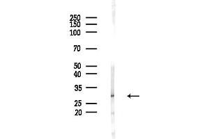 anti-Homeobox C6 (HOXC6) (N-Term) antibody