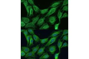 Immunofluorescence analysis of C6 cells using CNNM1 antibody (ABIN7266572) at dilution of 1:100. (Cyclin M1 抗体  (AA 692-951))