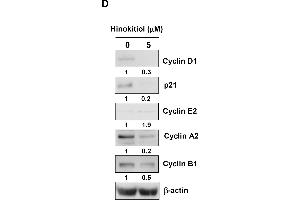 Western Blotting (WB) image for anti-Cyclin B1 (CCNB1) antibody (ABIN2854892)