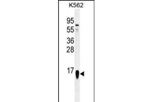 RPS19 Antibody (Center) (ABIN655978 and ABIN2845362) western blot analysis in K562 cell line lysates (35 μg/lane). (RPS19 抗体  (AA 25-54))