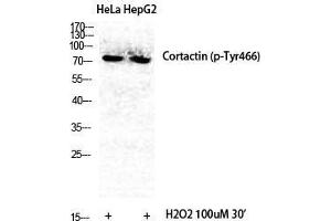 Western Blot (WB) analysis of specific cells using Phospho-Cortactin (Y466) Polyclonal Antibody. (Cortactin 抗体  (pTyr466))