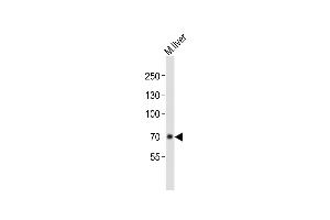 Anti-ALB Antibody (C-term)at 1:1000 dilution + mouse liver lysates Lysates/proteins at 20 μg per lane. (Albumin 抗体  (C-Term))